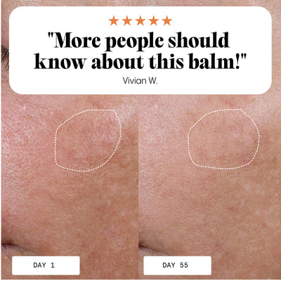 Anti-Age Day Balm for a Radiant Glow