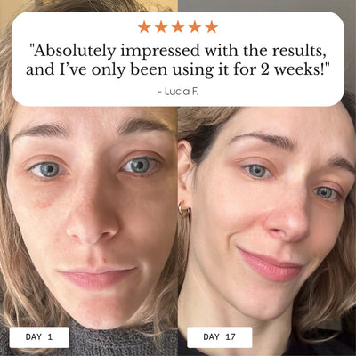Hyper-Potent Eye Balm for Dark Circles & Under-Eye Bags