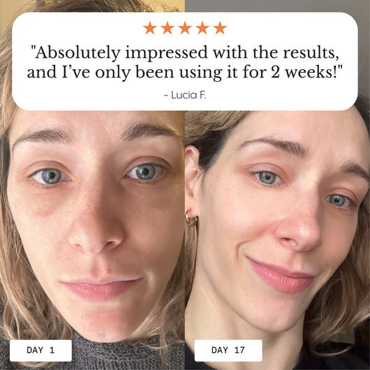 Hyper-Potent Eye Balm for Dark Circles & Under-Eye Bags