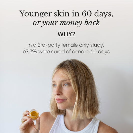 Hyper-Potent Eye Balm for Dark Circles & Under-Eye Bags