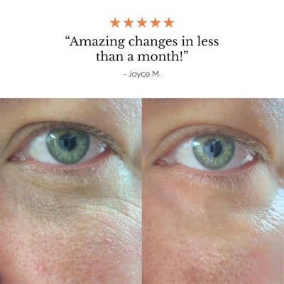 Hyper-Potent Eye Balm for Dark Circles & Under-Eye Bags