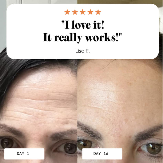 Miracle Wrinkle Eraser Overnight Balm