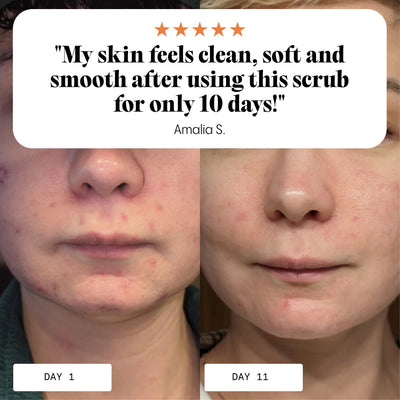 Ultra-Cleanse & Revive Facial Scrub